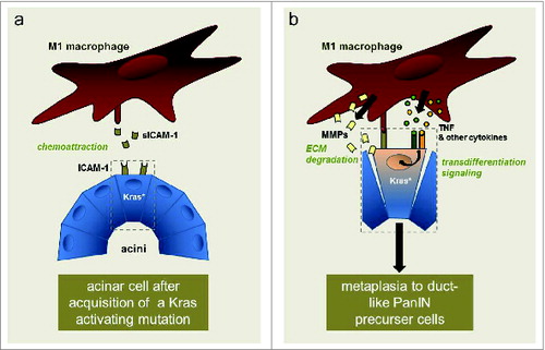 Figure 1. Crosstalk of macrophages with mutant Kras-expressing pancreatic acinar cells. Acquisition of an activating Kras mutation (Kras*) in acinar cells leads to expression of ICAM-1. A fraction of the ICAM-1 produced is shed and soluble (sICAM-1). Soluble ICAM-1 can act as a chemoattractant for M1-polarized macrophages (A). Macrophages then may directly interact with acinar cells via membrane ICAM-1. They provide enzymes that allow degradation of extracellular matrix (ECM) and inflammatory cytokines and chemokines that can drive transdifferentiation signaling. This leads to metaplasia of acinar cells to a duct-like phenotype that can give rise to pancreatic intraepithelial neoplastic (PanIN) lesions, which then can further progress to pancreatic cancer (B).