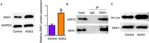 Figure 5. SIRT2 deacetylates DKK1 in KGN cells. (A) Protein level of DKK1 in KGN cells from Control and AGK2 groups. (B) Co-IP assay for the association between SIRT2 and DKK1 expression in KGN cells. (C) IP assay for DKK1 acetylation in KGN cells from Control and AGK2 groups. *p < .05; **p < .01.