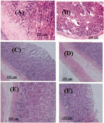Figure 6. Sections stained with hematoxylin and eosin (H&E; 100×) displaying the regenerated glandular epithelium width in stomachs of rats treated with indomethacin. Also, antiulcerogenic activity of MeOH and n-BuOH extracts of V. nubicum on indomethacin-induced ulceration in rats. (A) Negative control (2 mL saline); (B) Indomethacin (100 mg/kg b.w.); (C) MeOH extract (200 mg/kg b.w.); (D) MeOH extract (400 mg/kg b.w.); (E) n-BuOH extract (100 mg/kg b.w.); (F) n-BuOH extract (200 mg/kg b.w.).