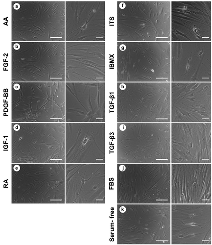 Figure 2. Morphology of cultured cells under the induction of studied biochemical cues after 14 days in culture: (a) ascorbic acid; (b) FGF-2; (c) PDGF-BB; (d) IGF-1; (e) retinoic acid; (f) insulin-transferrin-selenium; (g) IBMX; (h) TGF-β1; (I) TGF-β3; (J) foetal bovine serum; (k) serum-free control. Low magnification scale bar = 200 µm, high magnification scale bar = 50 µm.