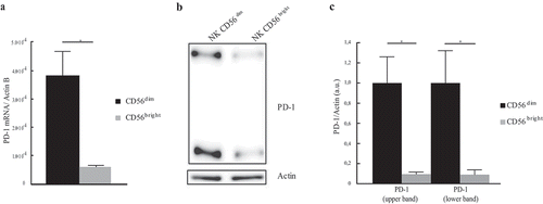 Figure 3. Different PD-1 mRNA and protein expression in CD56dim and CD56bright subsets. (a) PD-1 mRNA expression in sorted CD56dim (black column) and CD56bright (gray column) cells. PD-1 mRNA level was evaluated by RT-PCR amplification and normalized over Actin. Values, relative to three independent experiments are mean ± SEM. Statistical significance has been calculated by unpaired t-Test. (b) PD-1 protein expression in CD56dim and CD56bright NK subsets. A representative image from three independent experiments has been reported. (c) PD-1 protein quantification in CD56bright and CD56dim cells from three independents experiments. PD-1 values, normalized over Actin, are mean ± SEM and represent the PD-1 fold change calculated as a ratio between CD56bright and CD56dim cells. Statistical significance has been determined by unpaired t-Test.