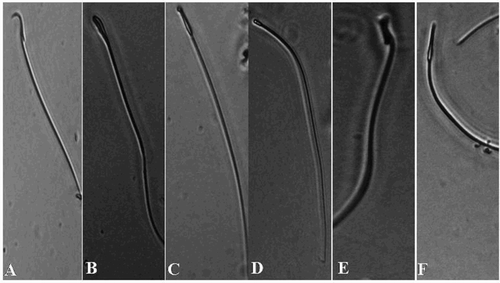Figure 2.  Phase-contrast micrographs of spermatozoa in epididymis with morphological abnormalities including: A) normal sperm, B) banana shaped hook less, C) hook less and elongated head, D) pin head, E) macro cephalous, and F) thin elongated head. Stained with eosin-nigrosin, 40 × magnification.