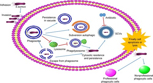 Figure 2 The mechanism of Staphylococcus aureus infection cells.Abbreviation: SCV, small colony variant.