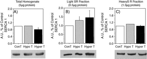 Figure 6.  Western blots showing SERCA isoform contents of white muscle from total homogenate, Light SR Fraction and Heavy SR fraction. Immunodetection was obtained with SERCA 1 specific monoclonal antibodies. 8 µg of total homogenate (A), 0.5 µg of light SR vesicles (B) and 1 µg of heavy SR vesicles (C) were used to load the gel. The tissue homogenate were centrifuged at 10,000 g for 20 min and the supernatants were used. HypoT and HyperT refer to samples obtained from hypo- or hyperthyroid animals. Densitometric analysis showing arbitrary units (A.U.) relative to control. The figure shows the average±SE of 3 and 4 different experiments.