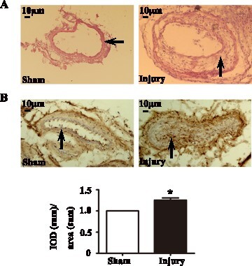 Figure 1. Representative images of the mouse artery 28 days after the procedure of femoral artery wire injury. (a) H&E staining of the arteries sections from sham and injured femoral arteries. Arrows refer to in-stent restenosis (arrow). (b) Immunohistochemical staining of CIZ1 on sections from sham and injured femoral arteries (arrow). The lower panel was the bar graph showing the IOD (sum)/area (sum) of each group. IOD, integrated optical density. n = 3, *, P < .05.