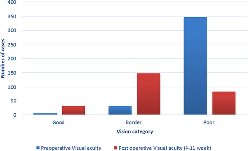 Figure 1 Preoperative and postoperative VA of cataract patients at Jimma Medical Center 2016–2017.