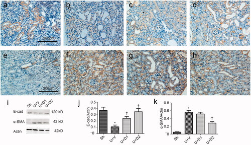 Figure 3. Representative photographs of E-cadherin (a-d) and α-SMA (e-h) staining. (a, e) Sh; (b, f) U + V; (c, g) U + D1; (d, h) U + D2. (i) Western blot analysis for E-cadherin and α-SMA. (j, k) Semiquantitative analysis for protein expression of E-cadherin and α-SMA. *p < 0.05 VS. Sh, †p < 0.05 VS. U + V. Scale bar = 200 μm.