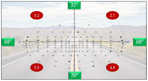 Figure 2 Example of an Esterman binocular visual field test printout. Green squares: mean visual field amplitudes (º) of the sample; red circles: average non-viewed points per quadrant, in all sample.