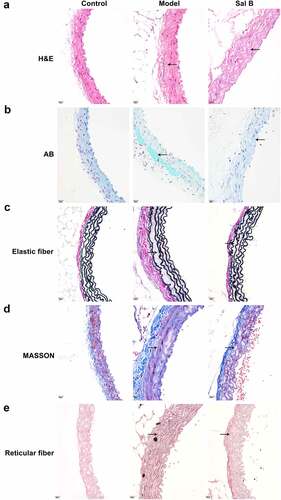 Figure 1. Sal B ameliorates diabetes-induced vascular pathology in db/db mice. (a–e) Representative images of (a) H&E staining, (b) AB staining, (c) elastic fiber staining (d) Masson staining, and (e) reticular fiber staining of thoracic aortas of db/m mice, db/db mice as well as db/db mice that were orally administrated 50 mg/kg Sal B for six weeks. Scale bar, 20 μm. Arrows indicate the abnormalities as claimed.