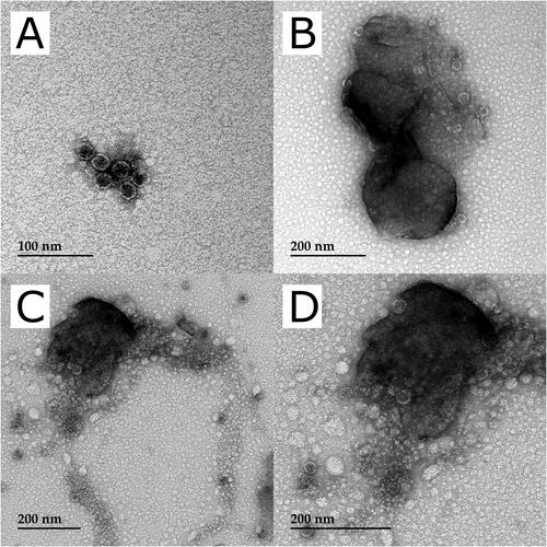 Figure 3. TEM imaging of lyophilized mixture of MS2 phages – ISO 12103-1 A3 medium test dust. (a) An aggregation of MS2 phages and fine dust particles indicated by the faint shading around the aggregate. (b) A larger dust particle bearing MS2 phages. (c) A broad view of MS2 phages associating with dust particles and existing potentially independently. (d) A closer image of the large aggregate at the top left in (c).