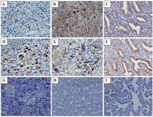 Figure 2. The spleen, liver and proventricular tissues stained by IHC. (A) ALV-J immunoreactivity in the lymphoid tumour cells and parts of the reticular cells in spleen. Magnification × 400. (B) ALV-J immunoreactivity in tumour cells in the liver. Magnification × 400. (C) ALV-J immunoreactivity in tumour cells in the proventricular gland cells. Magnification × 400. (D) MDV immunoreactivity in the lymphoid tumour cells in the spleen. Magnification × 400. (E) MDV immunoreactivity in the lymphoid tumour cells in the liver. Magnification × 400. (F) MDV immunoreactivity in the proventricular gland cells. Magnification × 400. (G) The spleen of non-infected chicken. Magnification × 400. (H) The liver of non-infected chicken. Magnification × 400. (I) The proventriculus of non-infected chicken. Magnification × 400.