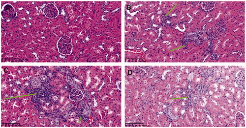 Figure 7. HE Chromatic graph of glomerular mesangial cells (A: normal group, B: IBU group, C: IBU-AG group, D: IBU-PSP group).