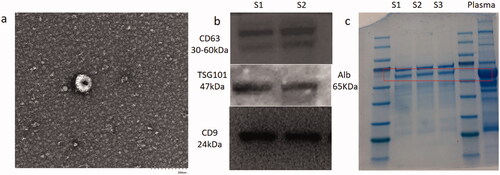 Figure 1. Identification of EVs. (a) Electron microscopic of EVs. (b) western-blot of EVs specific protein. s1, s2 means sample1 and sample 2 respectively. (c) western-blot of nano particles.