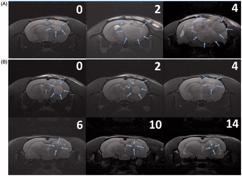 Figure 7. Serial MRI images. The number in the upper right corner of each image indicated the number of weeks after the treatment. (A) The implanted glioma in most rats in the gliadel group rapidly increased and resulted in a severe mass effect and death. (B) The rat in the HSNM group expressed a good response to HSNM treatment. The tumour volumes clearly decreased with time, and nearly disappeared at end of the study.