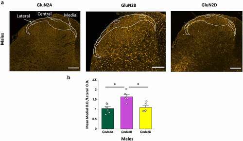 Figure 4. The GluN2B, but not GluN2A or GluN2D, isoform is preferentially expressed in the medial versus the lateral region of the SDH in male rats. (a) Representative confocal images (20x objective) illustrating the immunofluorescence for GluN2A (left), GluN2B (middle), and GluN2D (left). For each isoform, the OD per area was quantified in selected oval regions positioned within the medial, central and lateral regions of the CGRP+ SDH, as shown. There was a visible increase in intensity and distribution of fluorescent puncta in the medial SDH compared to the lateral SDH for GluN2B but not GluN2A or GluN2D. Scale bar: 200 µm. (b) Statistical analysis showing the mean medial vs lateral OD ratio for GluN2A, GluN2B and GluN2D. The medial/lateral OD ratio was significantly higher for GluN2B compared to both GluN2A and GluN2D. *p < 0.05
