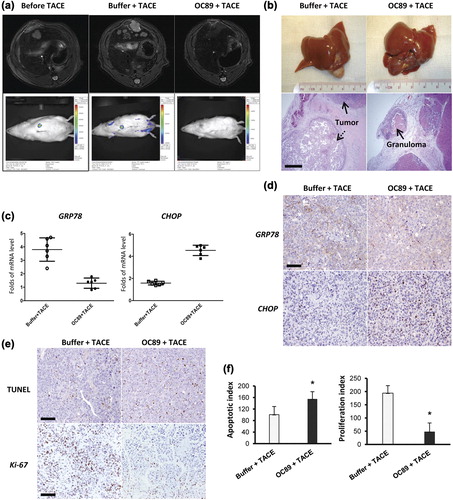 Figure 3. Enhanced therapeutic effect in TACE by OC89. (a) MRI or xenogen images in rats before or after TACE with or without OC89 delivery. The images were taken at Day 0 (left panel) or 21 days after TACE (middle and right panel). (b) Macro- and microscopic evaluation of tumors 21 days after TACE. In OC89-treated rat, the implanted tumor was replaced by granuloma (lower right, arrow) and proliferative fibrous tissue; while in rats receiving buffer, living tumor cells (lower left, solid arrow) accompanied with partial necrosis (lower left, dashed arrow) were observed. Bar = 20 um. (c) and (d) Altered expression of GRP78 and CHOP in rats at Day 1 after TACE. Bar = 100 um. (e) and (f) Increase of apoptosis (TUNEL assay, Day 1) and inhibition of proliferation (Immunostaining of Ki-67, Day 21) by OC89 in tumor cells after TACE. Bar = 100 um. *p < 0.05.