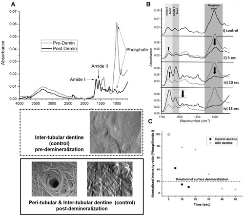 Figure 2 FTIR spectra (A) averaged composite FTIR spectra of control teeth pre-demineralisation (dotted line) and post-demineralisation (solid line). Images (SEM and AFM) present the control dentin surface pre- and post-demineralisation. (B) Infrared spectrum of the control (i) dentine, after 5 s (ii), 10 s (iii) and 15 s (iv) demineralisation. (C) Plot of pf the normalized intensity band ratio (Phosphate/Amide I) as function of the demineralisation time for control and OIDI dentin; dotted line marks the empirical threshold below which the surface is considered fully demineralised.