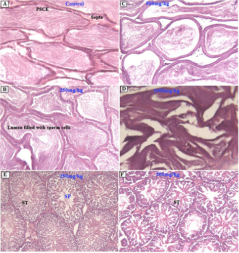 Figure 4 Photomicrographs of epididymis (A–D) and testis (E and F) sections (magnification: X100, H&E). Normal structural architecture of the epididymis (A–D) with pseudo-stratified columnar epithelium (PSCE) and lumen filled with secretory material. Normal testis structure (E and F) with seminiferous tubules (ST), and sperm cells at different stages of development (SP).