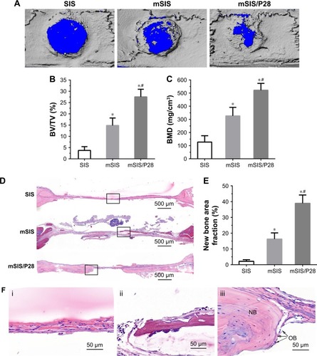 Figure 9 Evaluation of bone regeneration in calvarial defects of ovariectomized rats.Notes: (A) Representative micro-CT images of calvarial defects treated with SIS, mSIS, and mSIS/P28 membranes. (B and C) BV/TV and BMD in the cranial defect implanted with those membranes. (D) Representative H&E staining images of SIS, mSIS, and mSIS/P28 groups at 8 weeks postsurgery. (F) High magnification images of the black rectangles in D (i, SIS; ii, mSIS; and iii, mSIS/P28). The osteoblast and new bone are indicated by the abbreviations “OB” and “NB”, respectively. (E) Histomorphometry analysis of percentage of new bone area in the rat cranial defect. Statistical significance is indicated by *p<0.05 compared to pure SIS group and #p<0.05 compared to mSIS group.Abbreviations: BMD, bone mineral density; BV, bone volume; micro-CT, micro-computed tomography; mSIS, mineralized SIS; SIS, small intestinal submucosa; TV, tissue volume.