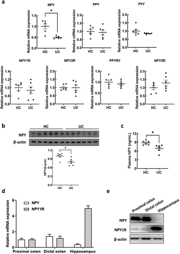 Figure 2. NPY expression in the colon and plasma of mice subjected to FMT by receiving feces from healthy control and UC patients. (a) mRNA expression of NPY family genes (NPY, PPY, and PYY) and their receptors (NPY1R, NPY2R, PPYR1, and NPY5R) in the colon of mice subjected to FMT by receiving feces from healthy control (HC-FMT; n = 6) and UC patients (UC-FMT; n = 6). (b) Representative bands and graphs showing western blot analysis of NPY protein in the colon of HC-FMT and UC-FMT mice. (c) Plasma levels of NPY in NC, HC-FMT, and UC-FMT mice measured by an enzyme-linked immunoassay kit. (d and e) colon and brain tissues were collected from control mice that were not subjected to FMT challenge. The mRNA (d) and protein (e) expression levels of NPY and its receptor NPY1R were evaluated in the colon and brain of the mice. Statistical significance between two groups was calculated using two-tailed unpaired t-test (*p < 0.05).