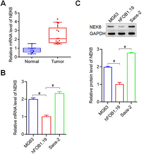 Figure 2 NEK6 was highly expressed in osteosarcoma tissues and cells. (A) NEK6 expression was higher in osteosarcoma tissues (Tumor tissues, n=13; Normal tissues, n=13). (B) The mRNA levels of NEK6 in osteosarcoma cells MG63 and Saos-2. (C) The protein levels of NEK6 in MG63 and Saos-2 cells. *P<0.05 vs normal tissues, #P<0.05 vs hFOB1.19 cells.