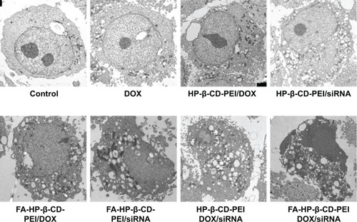 Figure 9 Morphological study of MCF-7/Adr cells after treatment with different modalities for 48 hours by Bio-TEM.Notes: TEM of MCF-7/Adr cells after treatment with different modalities showed the major ultrastructural changes for each sample. Concentrations of DOX and BCL2 siRNA were 0.5 μg/mL and 100 nM, respectively.Abbreviations: TEM, transmission electron microscopy; DOX, doxorubicin; siRNA, small interfering RNA; FA, folic acid; HP-β-CD, hydroxypropyl-β-cyclodextrin; PEI, polyethylenimine.