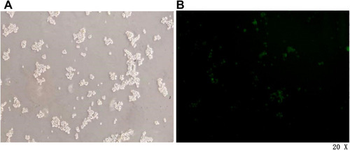 Figure 4 Pre-experimental CCSCs infected for 48 h under a microscope. (A) White light field. (B) Fluorescence field.
