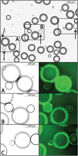 Figure 1. Representative images of an adipocyte suspension. Magnification 5X, bright field (top). Arrows indicate lipid droplets as identified by our ordinary manual means. Panels A-C show magnification 10X, bright field (left) and fluorescence (FITC, right); adipocyte membranes with fluorescent signal.