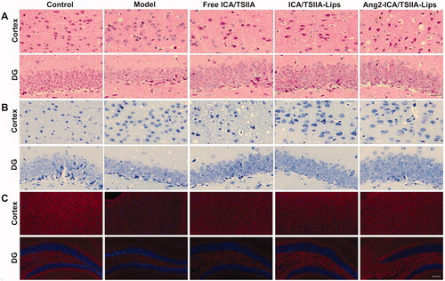 Figure 9. Improving effect of varying formulations on neuronal damage in APP/PS1 mice. (A) Representative images of HE staining of the cortex and hippocampus of APP/PS1 mice, scale bar = 250 μm (n = 6); (B) representative images of Nissl staining of the cortex and hippocampus of APP/PS1 mice, scale bar = 250 μm (n = 6); (C) representative images of SYN in cortex and hippocampus of APP/PS-1 mice by immunofluorescence staining, scale bar = 50 μm (n = 6).