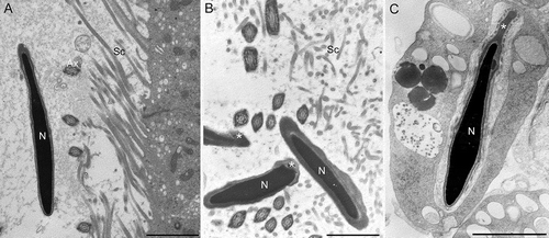 Figure 7. Transmission electron microscopy of sperm in the epididymal lumen at the level of cauda from wild type (A) and twitcher mouse (B,C). In twitcher epididymal lumen, misshaped sperms with structural acrosomal abnormalities (asterisk), large residual bodies, and cytoplasmic droplets are clearly visible. N: nucleus; Ax: axoneme; Sc: stereocilia. Scale bar 2 µm.