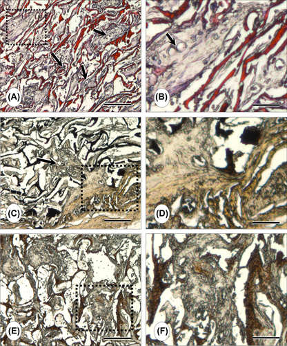 Figure 6. Representative light micrographs of cell-laden CS/HA scaffold grafts at day 14 (A–D) and at day 21 (E, F), post-transplantation. A, B: H&E staining; C–E: von Kossa staining; B, D and F are magnified images of A, B and C, respectively. Capillaries infiltrating newly forming tissue inside construct pores depict an ongoing neovascularization process (A, B). Mineralized ECM deposits are visible in C–F. Note the population of the construct pores with the newly forming tissue along with ECM and mineral deposits, with respect to culture time. Scale bars: 200 μm (A, C, E), 50 μm (B, D, F).