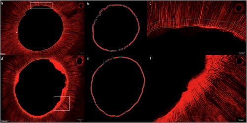 Figure 3. Confocal images with homogeneous sealer infiltration of dentin tubules for both groups in the middle root sections, group AH (photos a, b and c) conventional sealer (AH Plus Root Canal Sealer) and group RC (photos d, e and f) resin-based cement (ParaBond and ParaCore DENTIN SLOW). Left images: overview scans, middle images: fluorescence for quantification in working area and right images: magnifications of white rectangles in left images.