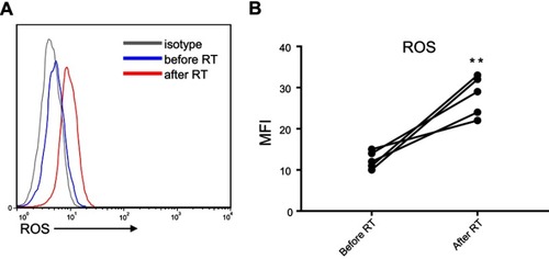 Figure S4 The expression of ROS in Cell subsets was detected by FACS in patients before radiotherapy and post-radiotherapy. (A) The represent data of flow image. (B) The statistical data shown that ROS significantly increased after RT. Columns and error bars represent mean + SEM. **p<0.01.