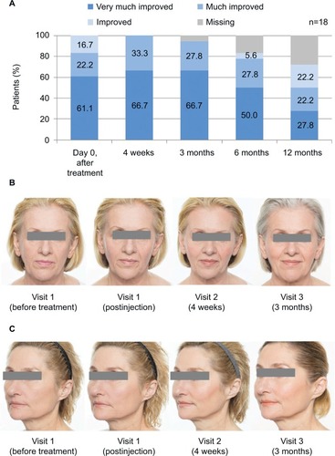 Figure 1 Assessment of the cosmetic result (A) on the GAIS and by means of photo documentation of (B) a 59-year-old patient and (C) a 55-year-old patient.