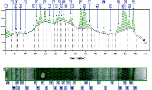 Figure 4. Graphical representation of a Western blot profile of the same animal as in Figure 3 for the IgG isotype. IgG showed relatively higher staining intensities than IgM, but the backgrounds are comparable. The number of fragments recognized is lower (30) for IgG as compared to IgM (39, Figure 3). Arrow indicates ‘background’ staining.