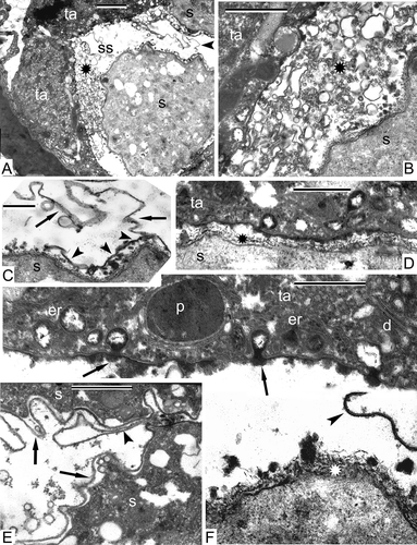 Figure 12. Very young free spores in Alsophila setosa. A. Neighbouring spores are separated from each other; tapetal cells maintain their parietal position; different kinds of accumulations (asterisk) are present in the sporangium space; an outgrowth of a spore envelope, probably the initial proximal fold (arrowhead). B. Vesicles of different size and form and spherical units (asterisk) in sporangia-supporting liquid between the tapetum and a young spore. C. Proximal side of a young spore with initial proximal fold (arrows) and tripartite membrane (arrowheads). D. Fibrillar envelope of a young spore in close vicinity to the tapetum. E. Two neighbouring young spores with wavy outlines and sinusoidal initial layer of the sporoderm (arrows); a loop of the proximal fold (arrowhead). F. A young spore, adjacent to tapetum; the tapetal cell has a negative contrast (white membranes and dark stroma of organelles); in the tapetum, plastids with large inclusion, wrapped in endoplasmic reticulum cisternae, dictyosomes, cisternae of endoplasmic reticulum and their large vesicles are visible, some vesicles open to the tapetal cell surface and release their content into the sporangium loculus (arrows); the surface of the spore is covered by a fibrillar envelope with addition of osmiophilic spherical units (asterisk); a fragment of tripartite membrane in sporangia-supporting liquid (arrowhead) is probably detached from the spore surface. Abbreviations: see Figure 1. Scale bars – 2 μm (A), 1 μm (B, E), 500 nm (C, D, F).