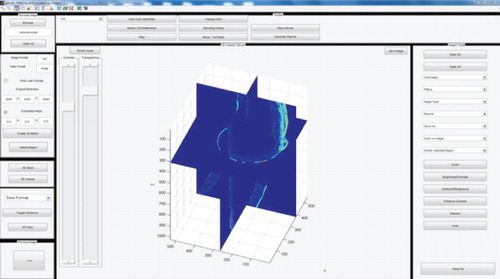 Figure 1: The interactive interface of BioFilmViewer.