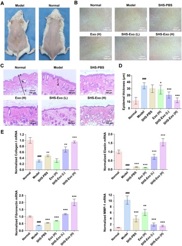 Figure 5 Enhanced anti-aging effects of hucMSC-Exos on photoaged mouse skin by using SHSs. (A) Macroscopic observation of photoaged skin induced by UV-irradiation in mice. (B) Changes in microwrinkles of photoaged skin by different treatments. (C) Histopathological analysis (H&E staining) of photoaged skin after different treatments. Labels: a, epidermis; b, dermis; c, subcutaneous tissue; d, dermal-epidermal junction. (D) Epidermis thickness of photoaged skin after treatments. (E) mRNA expressions of dermal ECM-related genes after treatments. All data were expressed as mean ± SD (n = 4). *p < 0.05, **p < 0.01, ***p < 0.001, versus the model group; ###p < 0.001, versus the normal group.