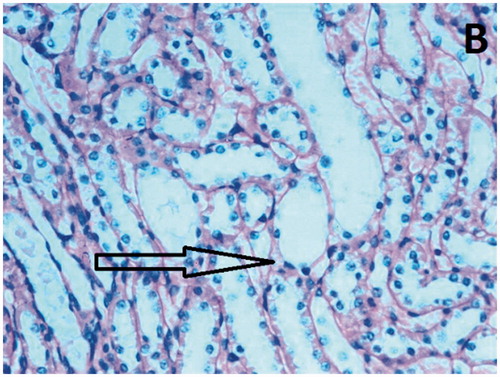 Figure 3. Brush border loss, tubular dilatation and tubular vacuolization in renal tissue after Group I.