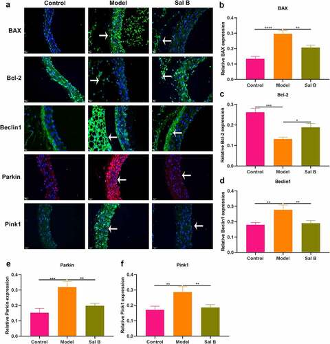 Figure 3. Effects of Sal B on apoptosis and mitophagy in thoracic aortas of db/db mice. (a) Representative images of immunofluorescence of BAX, Bcl-2, Beclin1, Parkin, and Pink1 in thoracic aortas from db/m mice, db/db mice as well as db/db mice that were orally administrated 50 mg/kg Sal B for 6 weeks. Scale bar, 20 μm. Arrows indicate the abnormalities as claimed. (b–f) Quantification of the expression of BAX, Bcl-2, Beclin1, Parkin, and Pink1 in thoracic aorta of above mice. *P < 0.05; **p < 0.01; ***p < 0.001; ****p < 0.0001.