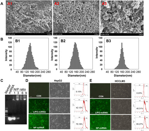 Figure 2 Characterization and transfection efficiency of nanoparticle/miRNA complexes.Notes: (A) Typical SEM images of the PLGA nanopartitcles (A1), PEI-modified nanoparticles (A2), and nanoparticle/miRNA complexes (A3); magnification 15,000×. (B) Hydrodynamic diameter distribution of the PLGA nanoparticles (B1), PEI-modified nanoparticles (B2), and nanoparticle/miRNA complexes (B3). (C) Agarose gel electrophoresis assay of miRNA/nanoparticle complexes at different N/P ratios. (D and E) Typical fluorescent images, corresponding bright images, and transfection efficiency of cells transfected with nanoparticle/FAM–miRNA complexes or lipofectamine/FAM–miRNA complexes. The scale bar represents 100 μm; magnification is 200×.Abbreviations: CON, control; LIPO, lipofectamine; miRNA, microRNA; NP, nanoparticle; PLGA, poly(lactic-co-glycolic) acid; SEM, scanning electron microscopy; PEI, polyethylenimine.