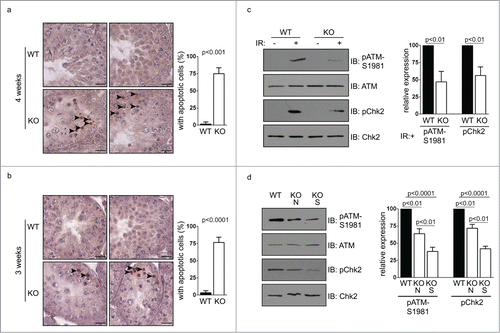 Figure 5. Apoptosis occur in germ cells from Chfr knockout male mice. (a-b) Apoptosis was detected in testis sections of 3 and 4-week-old male mice. Apoptotic cells are marked by arrow heads. Seminiferous tubules with apoptotic cells are summarized. Scale bar, 50 µM. (c) Levels of ATM, phosphorylated ATM at serine 1981, Chk2, and phosphorylated Chk2 are shown in WT and Chfr knockout MEFs with or without ionizing radiation (IR). (d) Levels of ATM, phosphorylated ATM at serine 1981, Chk2, and phosphorylated Chk2 are shown in 3-week-old WT and Chfr knockout testes. N, normal size testes. S, small testes. Quantification was performed. Mean and standard deviation are shown.