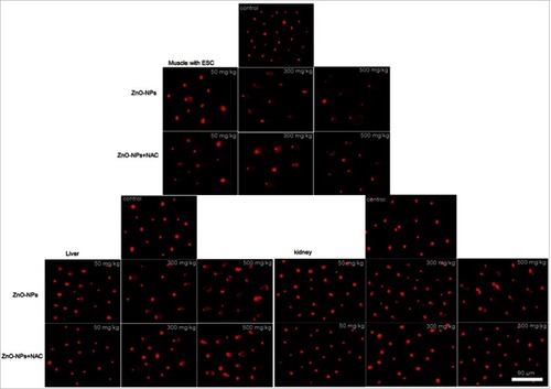 Figure 8 Representative fluorescent microscope photomicrographs demonstrating the extent of DNA damage assessed by alkaline comet assay in muscle with ESC, liver and kidney cells of tumor-bearing mice.