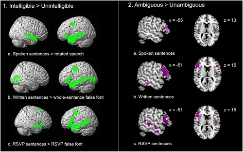 Figure 4. Results of the whole-brain analyses. Brain activation in the contrast of intelligible > unintelligible sentences (panel 1), and ambiguous > unambiguous sentences (panel 2) in each of the presentation formats.