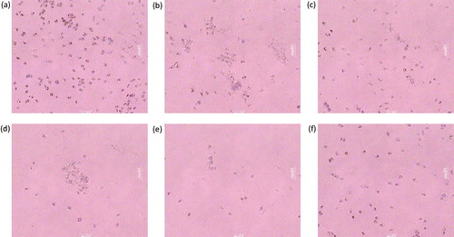 Figure 4. Effect of piperine treatment (10, 20, and 40 mg/kg) and disodium cromoglyacate (50 mg/kg) on mast cell degranulation. (a) The normal group showing intact mast cells, (b) the AR control group showing degranulation of mast cells, (c) montelukast (10 mg/kg) treated group section showing partial cell degranulation, (d) PIP (10 mg/kg), (e) PIP (20 mg/kg), and (f) the PIP (40 mg/kg) treated group shows stabilization of mast cells in a dose-dependent manner.