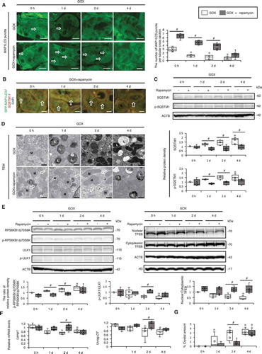 Figure 6. MTOR inhibition suppresses kidney crystal formation. (A) Numbers of GFP-MAP1LC3 puncta (arrows) per tubular cross-section in RTCs with or without rapamycin of LC3-mice treated with GOX. At least 30–50 tubules were counted (n = 5/group). The 0 h (GOX) group was injected with the same amount of PBS 1 day before sacrifice. The 0 h (GOX + rapamycin) group was injected with the same amount of PBS and the same amount of rapamycin 1 day before sacrifice. (B) Fluorescence immunostaining of SQSTM1 (red) and counterstaining with DAPI (blue) in MAP1LC3-mice. Arrows indicate MAP1LC3 puncta. (C) Relative protein density, determined by western blotting of SQSTM1 and p-SQSTM1, in the kidneys from LC3-mice with GOX and/or rapamycin (n = 5/group). (D) TEM images. Arrows indicate autolysosomes. M, mitochondria; L, lysosome. (E) Relative protein density, determined by western blotting of RPS6KB1/p70S6K, p-RPS6KB1/p70S6K, ULK1, p-ULK1, and nuclear and cytoplasmic TFEB in kidneys from LC3-mice with GOX and/or rapamycin (n = 5/group). (F) Gene expression of Lamp1 and Uvrag-DT in kidneys extracted from LC3-mice with GOX and rapamycin injection (n = 5). (G) Amount of crystals formed in kidneys extracted from LC3-mice after GOX and/or rapamycin injection (n = 5/group). Scale bars: 20 μm (B), 10 μm (A), and 0.5 μm (D). Each value at 0 d (GOX without rapamycin) was adjusted to ‘1’ as a reference (C, E). *P < 0.05 versus GOX 0 h, #P < 0.05, and †P < 0.05 versus GOX + rapamycin 0 h.