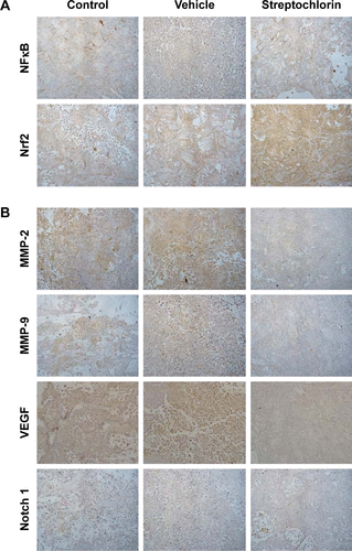 Figure S3 Immunohistochemical staining of solid tumor of animal tumor model in Figure 5A.