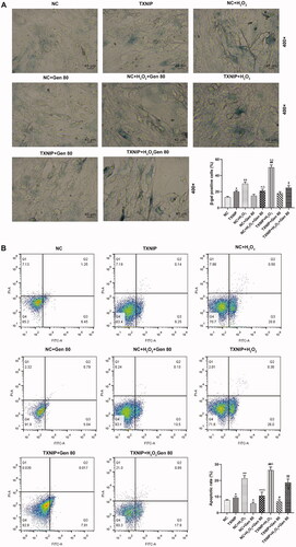 Figure 6. Overexpressed TXNIP partially reversed the effect of Gen on H2O2-induced senescence and apoptosis of HUVECs. HUVECs were transfected with overexpressed TXNIP plasmid, treated with H2O2 or Gen alone or combination. (A) After transfection of overexpressed TXNIP plasmid, H2O2-induced HUVEC senescence after 80 μg/mL Gen treatment was detected by β-galactosidase staining. Magnification: ×400, scale bar = 40 µm. (B) After transfection of overexpressed TXNIP plasmid, H2O2-induced HUVEC apoptosis after 80 μg/mL Gen treatment was detected by flow cytometry. All experiments were performed in triplicate and the experimental data were expressed as mean ± standard deviation (SD) (*p< 0.05, **p< 0.01, vs. NC; ∧p< 0.05, ∧∧p< 0.01, vs. NC + H2O2; #p< 0.05, ##p< 0.01, vs. TXNIP; ‡p< 0.05, vs. NC + H2O2+Gen80; Δp< 0.05, vs. NC + Gen80). HUVECs: human umbilical vein endothelial cells; TXNIP: thioredoxin-interacting protein; NC: negative control.