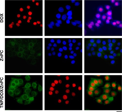 Figure 4 Cellular uptake of free drugs and TNP/DOX/ZnPC at the DOX concentration of 17.8 µg/mL and ZnPC concentration of 20 µg/mL against 5637 cells.Note: The scale bar was 25 µm for all images.Abbreviations: DOX, doxorubicin; TNP, thermal-responsive nanoparticle; ZnPC, zinc phthalocyanine; TNP/DOX/ZnPC, mixture of equivalent mole of TNP/DOX and TNP/ZnPC.