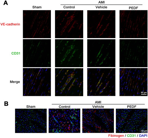 Figure 2. PEDF protect endothelium integrity. (A) Fluorescence imaging of VE-cadherin and CD31. (B) PEDF reduces blood vessel leakage. Fluorescence imaging of fibrinogen after incubation with PEDF.